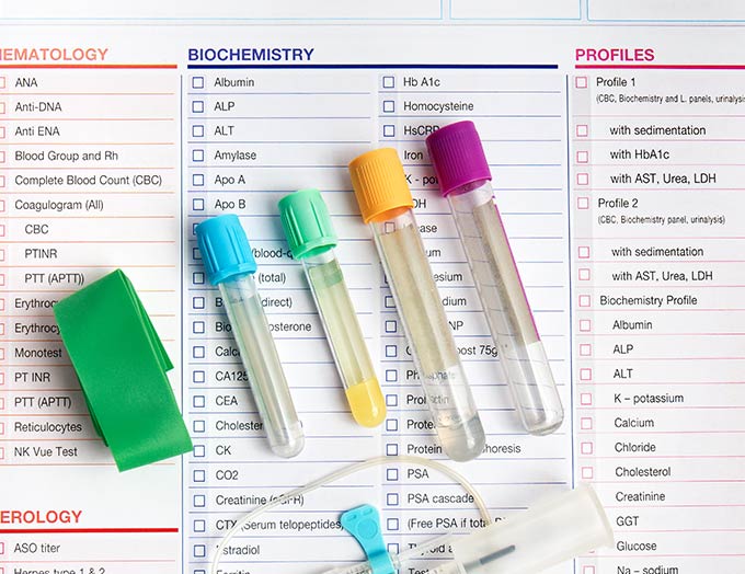 Laboratory test Includes comprehensive health analyzes that identify hormonal imbalances and other possible causes, which form the basis of your personalized treatment plan.